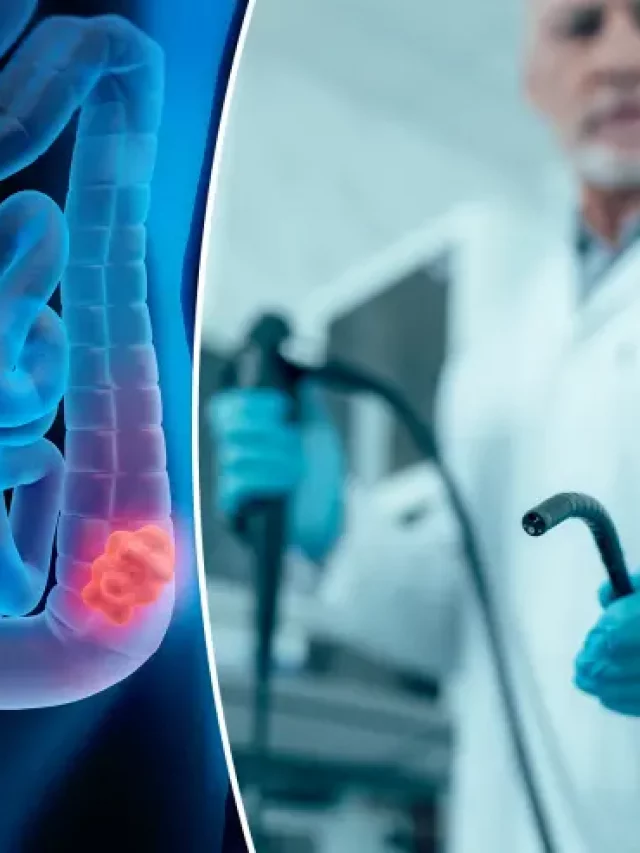 Colonoscopies Are Not As Beneficial as We Think